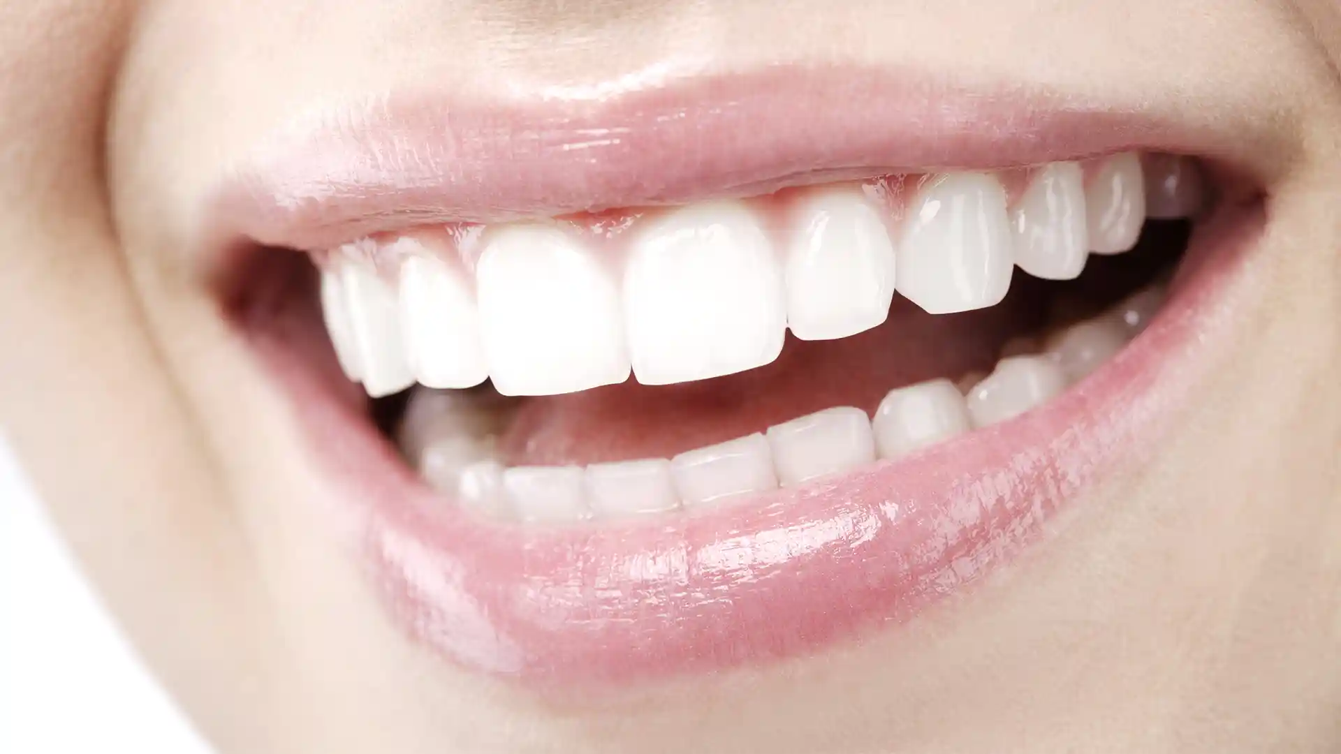 Sydney Sweeney Teeth